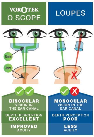 Vorotek Perception Loupes v OScope