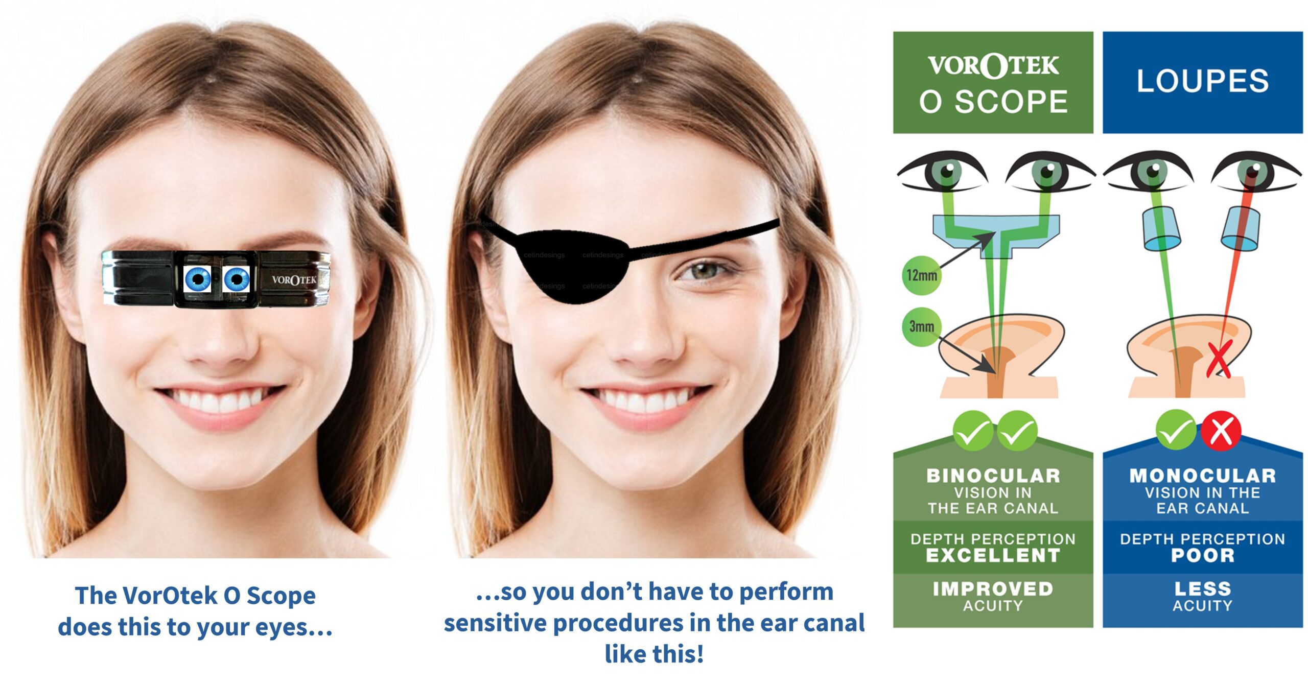 How the VorOtek O Scope is able to view deep into an ear canal for accurate depth perception