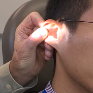Jv Straighten Ear Canal